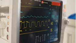 New study links heart attacks to higher risk of dementia