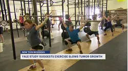 Yale School of Medicine uncovers breakthrough in cancer research