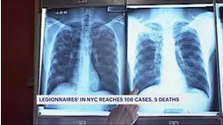 5 deaths, 108 confirmed cases of Legionnaire's disease in New York City