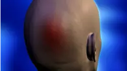 Hit and Run