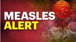 Health officials warn of possible measles exposure at Newark Liberty in July