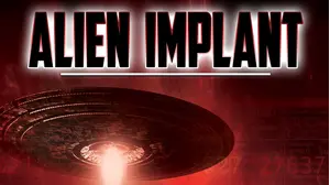 Alien Implant