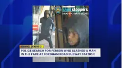 Man slashed in the face on 4 train platform in Fordham