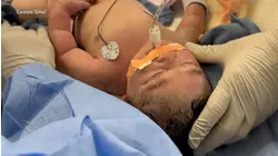 Baby born after rare and dangerous ectopic pregnancy