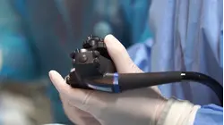 Study Finds Rectal Cancer Deaths Rising in Younger Adults