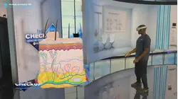 What happens to your skin when you get burned