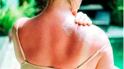 First New Sunscreen Type in 25 Years Hits US Store Shelves