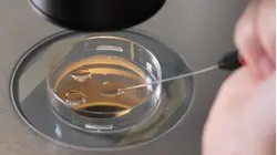 How custody agreement was reached in IVF mix-up