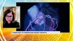 Doctor urges viewers to recognize the warning signs of a heart attack