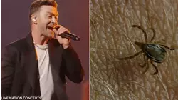 Justin Timberlake reveals Lyme disease diagnosis; what to know about the illness