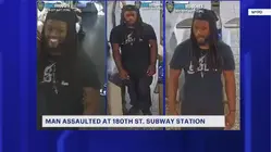 Man wanted in connection with East 180th Street station assault