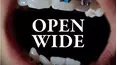 Open Wide