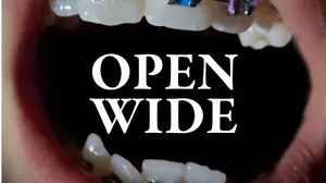 Open Wide