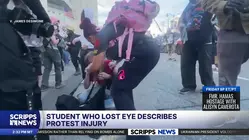 'This is permanent': College student who lost eye photographing protest describes life-altering injury