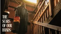 The Scars of Our Hands