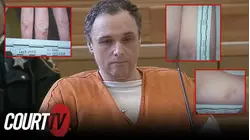 Surgeon Accused of Murder Had Bruises All Over His Body: Deputy