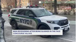 Man hospitalized after slashing in Concourse Village