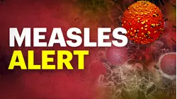 Officials: 3rd case of measles confirmed, state seeing the highest number of cases since 2019