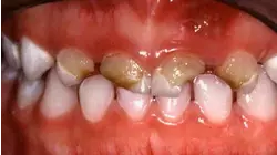 Ouchtastic! Teeth
