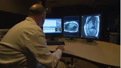 Updated heart disease guidelines aim to prevent cardiac events before they happen