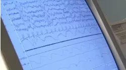 The Frankenstein of Sleep