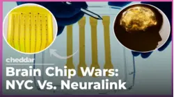 This NYC Startup Is Implanting More Brain Chips Than Neuralink