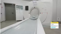 The importance of lung cancer screenings