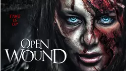 Open Wound
