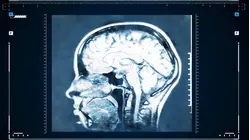 New study on which foods might preserve your brain health