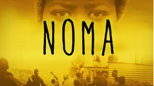 Noma