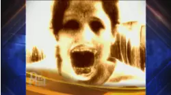 Schizophrenics and Extreme Disorders