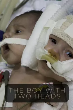 The Boy With Two Heads