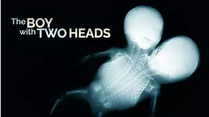 The Boy With Two Heads