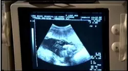 Columbia lab develops tools helping doctors better prevent serious pregnancy issues