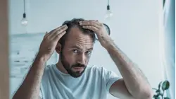 New study raises questions about GLP-1s, hair loss and men