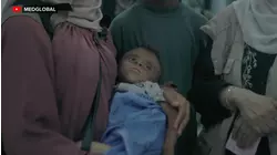 'We are seeing the death': Doctor on Gaza malnutrition report