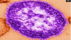 Measles virus found in New Jersey wastewater
