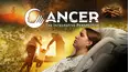 Cancer: The Integrative Perspective
