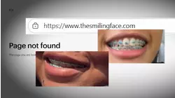 More patients left stuck with braces speak out after provider closes