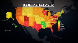 Pennsylvania reports 2 new measles-related deaths