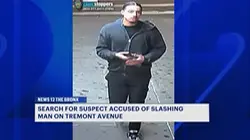 Man slashed in the face in East Tremont