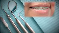 Patients left with braces on their teeth after provider closes up shop