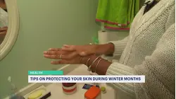 Tips to avoid dry, itchy skin during the winter