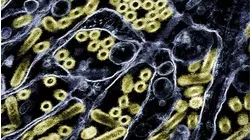 1st human known to be infected with H5N5 strain of bird flu dies