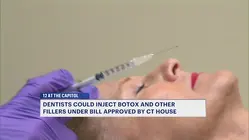 Dentists could inject Botox and other fillers under bill approved by Connecticut House of Representatives