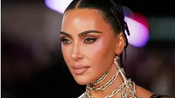 Kim Kardashian says she was diagnosed with an aneurysm