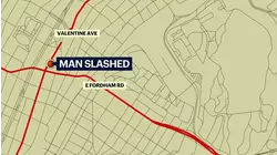 Man slashed during argument in Fordham