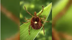 NJ man is 1st confirmed death linked to a meat allergy spread by ticks
