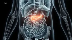 How a new drug could lengthen lives of pancreatic cancer patients