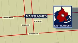 Man slashed in the abdomen in East Flatbush